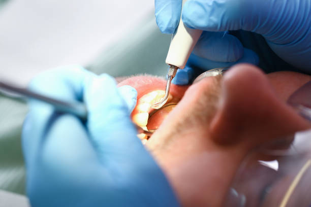 Best Emergency Gum Pain Relief  in Rineyville, KY